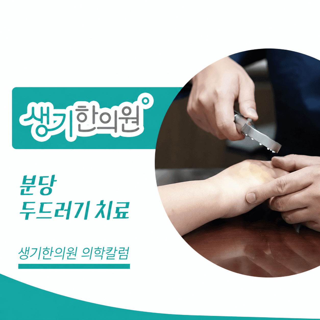 생기한의원 분당점 두드러기 증상과 반복 양상 의학칼럼과 피부 진료 사진