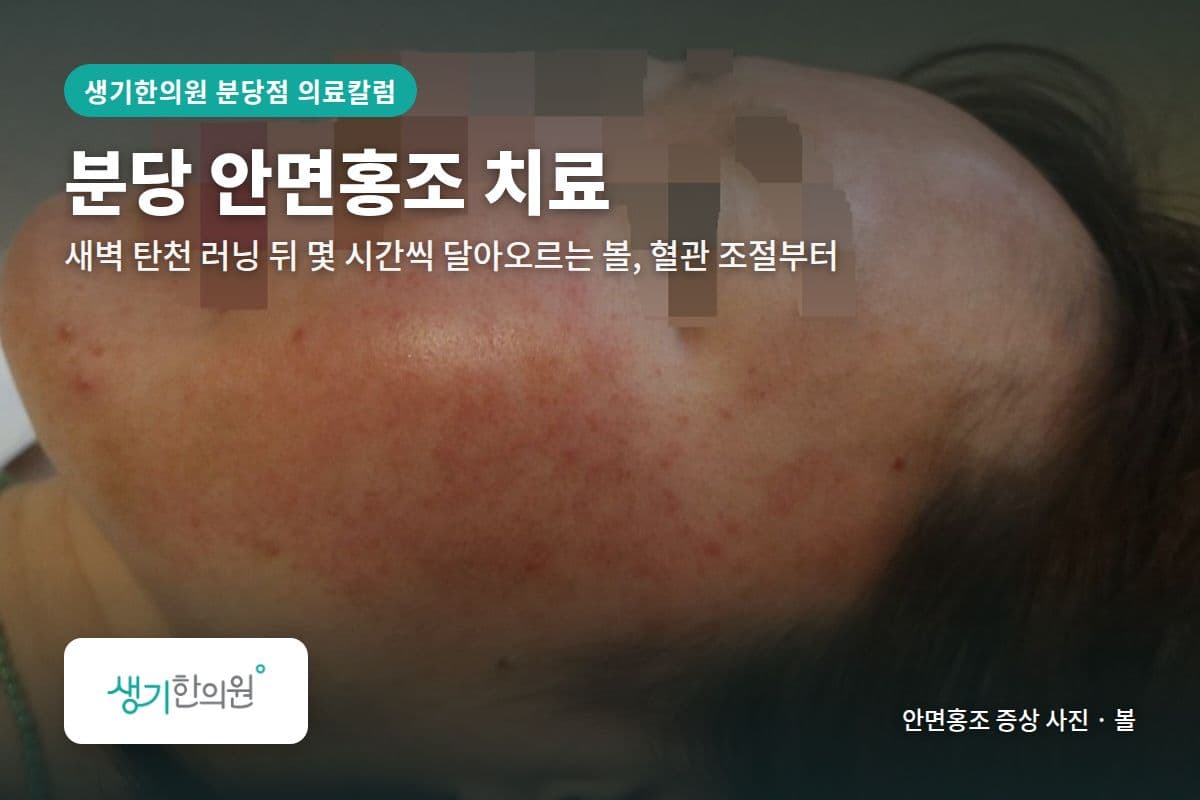 볼 안면홍조 증상 사진과 문구 「분당 안면홍조 치료, 새벽 탄천 러닝 뒤 몇 시간씩 달아오르는 볼, 혈관 조절부터 · 생기한의원 분당점」