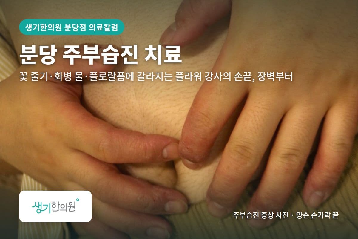양손 손가락 끝 주부습진 증상 사진과 문구 「분당 주부습진 치료, 꽃 줄기·화병 물·플로랄폼에 갈라지는 플라워 강사의 손끝, 장벽부터 · 생기한의원 분당점」