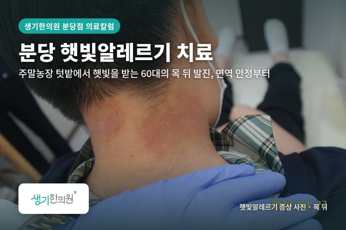 목 뒤 햇빛알레르기 증상 사진과 문구 「분당 햇빛알레르기 치료, 주말농장 텃밭에서 햇빛을 받는 60대의 목 뒤 발진, 면역 안정부터 · 생기한의원 분당점」